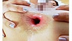 ロシアン尻穴マニア 7