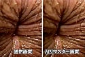 【AIリマスター】おしりの穴 おしりの穴編 12