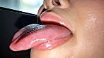 【個人撮影】谷田かりなの舌ブラシで「汚舌苔」採取 4