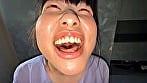 【個人撮影】谷田かりな 開口器で口内観察デカ舌を要チェック 3
