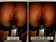 【AIリマスター】おしりの穴 おしりの穴から出てくる物編 4