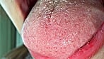 【個人撮影】水月みおの舌ブラシで「汚舌苔」採取 12