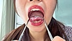 【個人撮影】水月みおの舌ブラシで「汚舌苔」採取 15