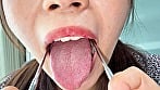 【個人撮影】水月みおの舌ブラシで「汚舌苔」採取 16