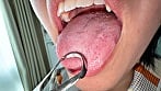 【個人撮影】加護まりの舌ブラシで「汚舌苔」採取 4