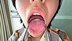 【個人撮影】加護まりの舌ブラシで「汚舌苔」採取 13