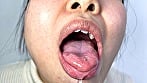 唾液たっぷりかりなちゃんの口内観察 16