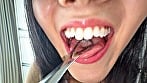 【個人撮影】桃瀬まゆの舌ブラシで「汚舌苔」採取 6