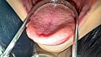 【個人撮影】桃瀬まゆの舌ブラシで「汚舌苔」採取 10