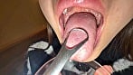 【個人撮影】さくまつなの舌ブラシで「汚舌苔」採取 11