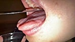 【個人撮影】さくまつなの舌ブラシで「汚舌苔」採取 13