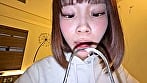 【個人撮影】渡来ふうの舌ブラシで「汚舌苔」採取 13