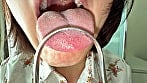 【個人撮影】浅桜エリの舌ブラシで「汚舌苔」採取 16